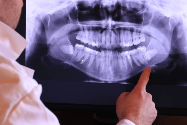 Best Emergency Root Canal Treatment in Washington, KS
