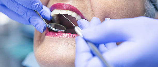 Best Emergency Denture Repair in Washington, KS